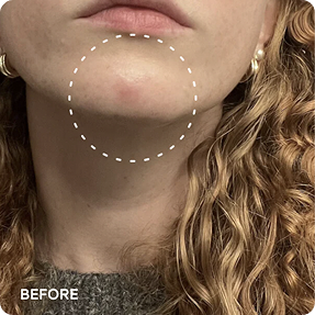 JiYu Anti-Aging Glow-Up Bundle